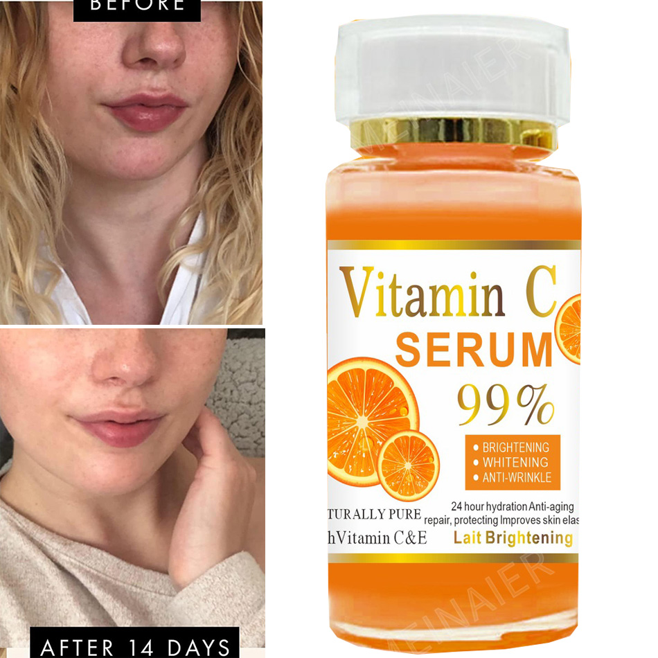 Vitamin C Serum Face - Super 120ml Vitamin C Serum Anti-aging