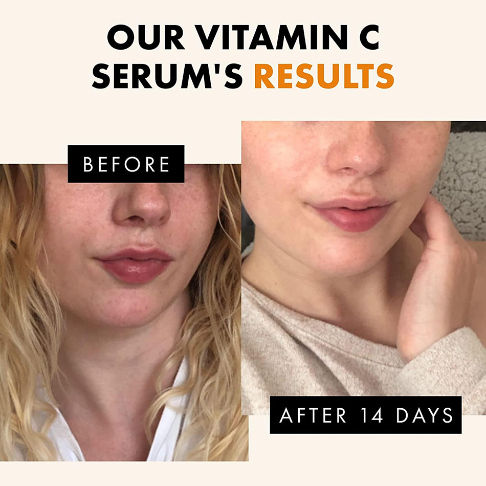 Super 120ml Vitamin C Serum An - Vitamin C Serum Face ulasan dan harga